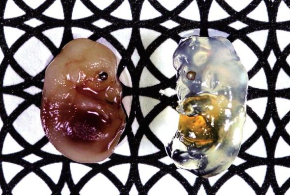 这是一个小鼠胚胎，左侧是经盐水浸泡后的效果，右侧则是经过Scale试剂浸泡过后的效果
